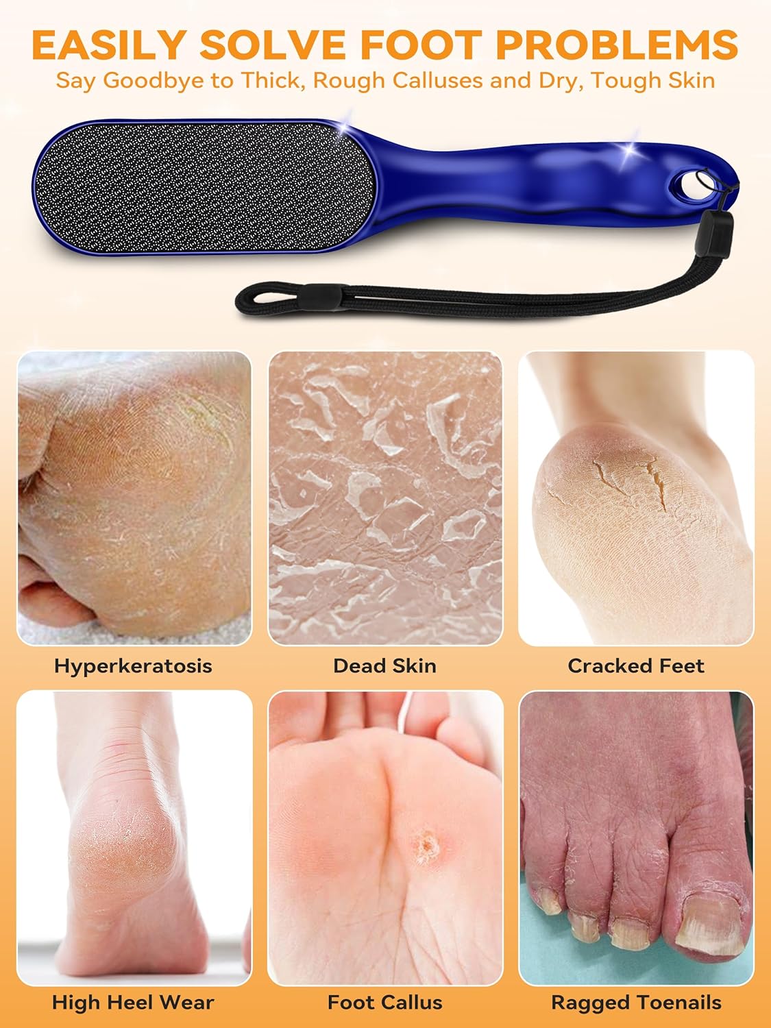 Beyond The Cream Veins Grain Foot File, Nano Glass Foot File, Hard Skin Callus Remover, Professional Pedicure Tool, Anti-Slip Handle Rope & Storage Bag, Ideal Gift for Beauty & Fitness Lovers, Blue