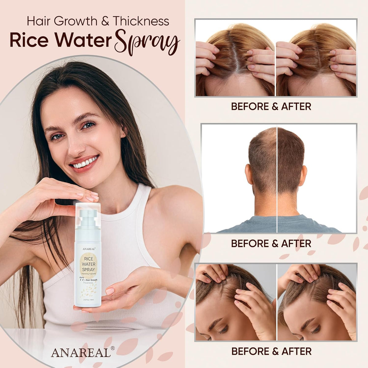 Hair Growth Oil Spray: Fermented Rice Water with Biotin & Castor Oil for Daily Hair Thickening & Scalp Nourishment - Natural Non-greasy 2oz