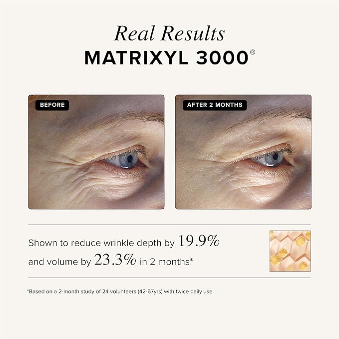 Asterwood Triple Repair Matrixyl 3000 + Argireline + Hyaluronic Acid + Vitamin C Serum for Face - Anti-Aging, Collagen Boosting, Hydrating - Fragrance-Free - 2 Fl Oz