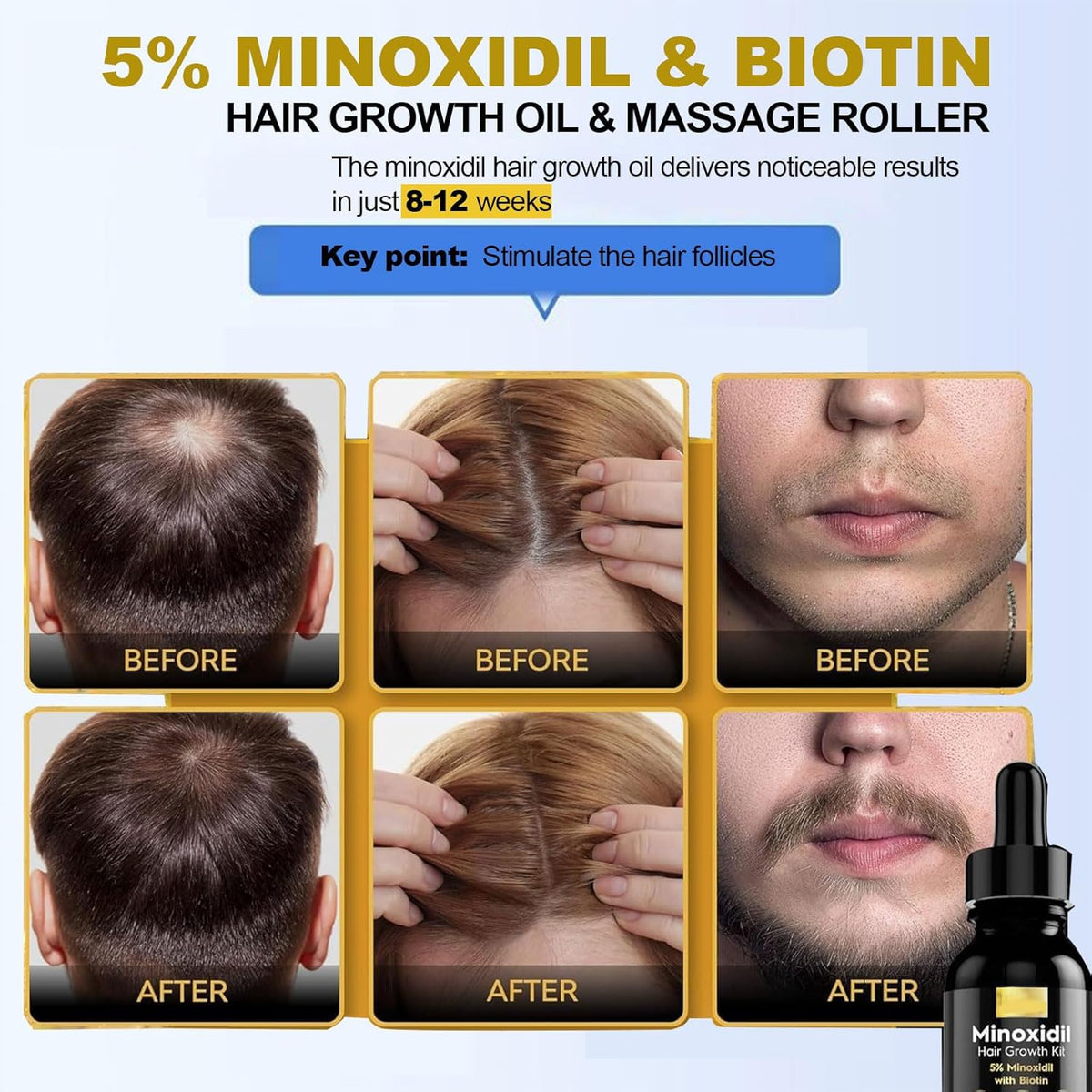5% Minoxidil for Men, Beard Growth Kit, Hair Regrowth Serum for Hair Loss Treatment, Fuller & Thicker & Healthier Hair for Men & Women, with Massage Helper with Protective Cover