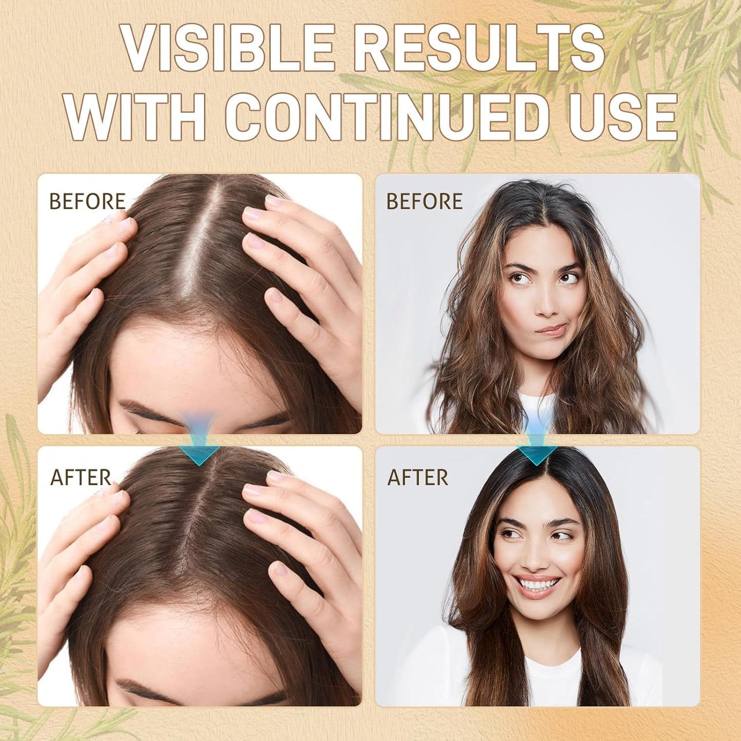 Rice Water Hair Growth Serum - Infused with Rosemary, Biotin, Caffeine, Non-Greasy Formula for Hair Loss, Damaged & Dry Hair, Thicker, Longer, Fuller Hair (3.38 OZ(Upgrade))