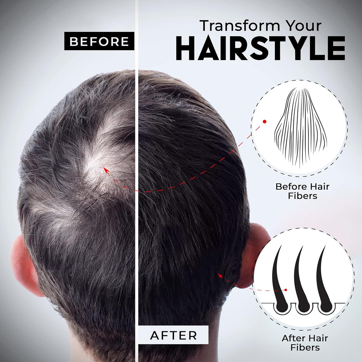 ELEVATE Hair Fibers to Instantly Thicken & Completely Conceal Thinning Balding Areas Loss in 30 Seconds for Men & Women (BLACK) 28g Size - 100% Natural & Undetectable Keratin Fibers